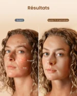 Masque de luminothérapie LED Artemis Blush E100B-1 – RENPHO – Image 9